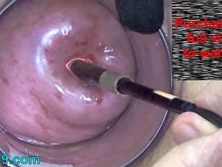 Wifey Cervix toying with Endoscope asian web cam into Uterus