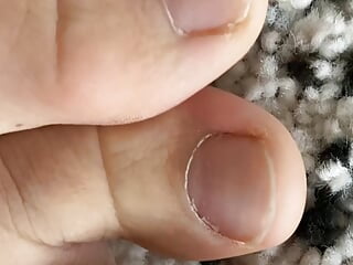 Inborn toenails close look. Soles fetish